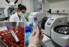 CRP: Blutuntersuchung des C-reaktiven Proteins