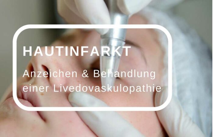 Hautinfarkt – Anzeichen und Behandlung einer Livedovaskulopathie