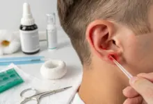 Ohrloch entzündet: Ursachen, Behandlung & Hausmittel