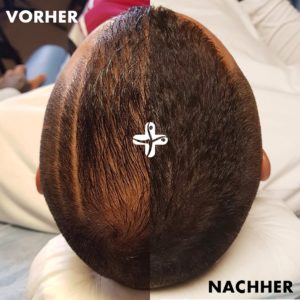 Quaresma Vorher Nachher