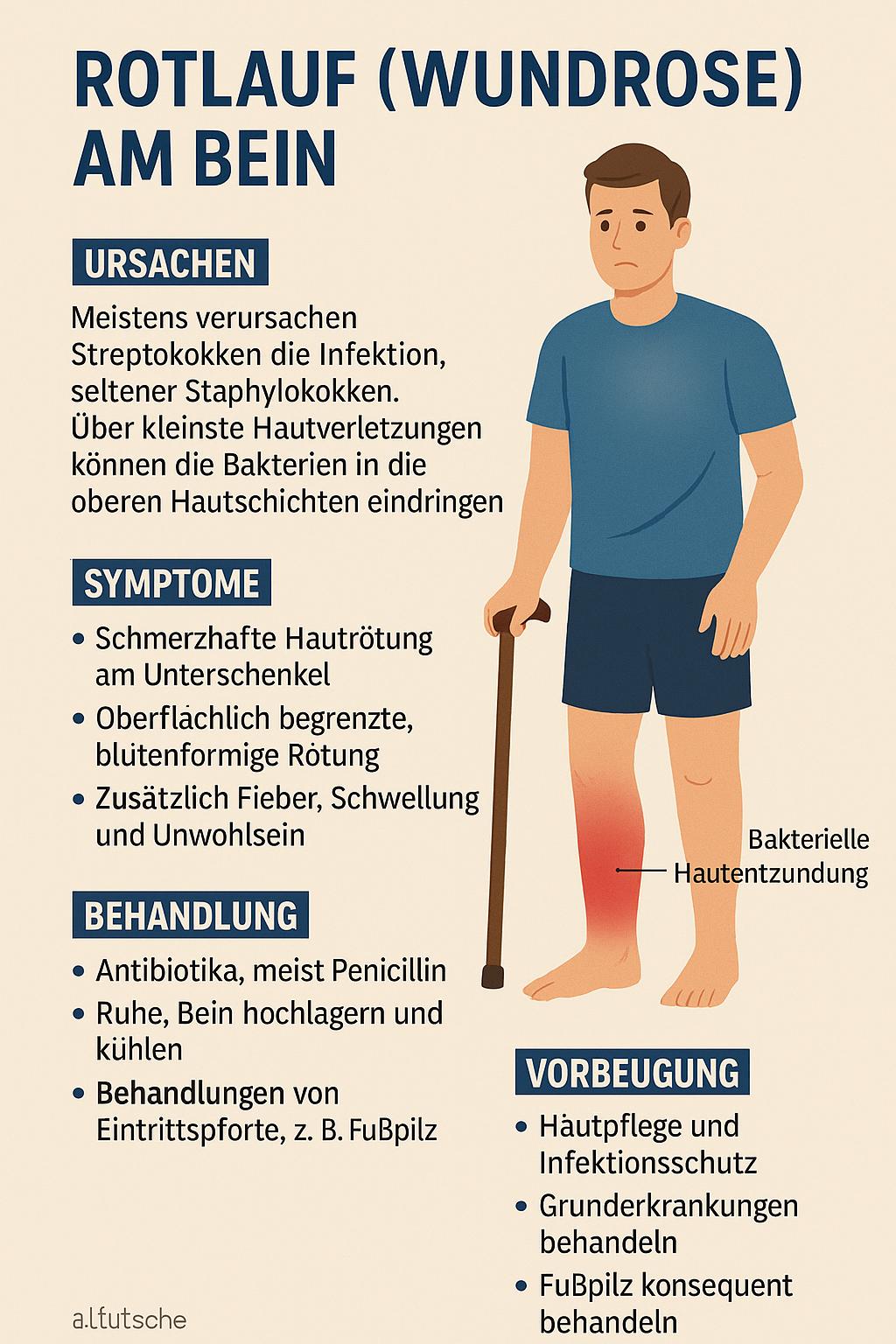 Rotlauf (Wundrose) am Bein: Ursachen, Symptome und Behandlung