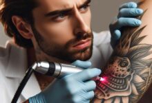 Gründe und Methoden zur Tattooentfernung