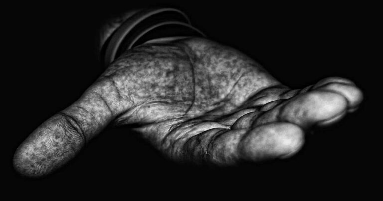 Daumensattelgelenkarthrose Symptome und Therapie