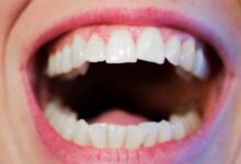 Welche Munddusche empfehlen Zahnärzte?
