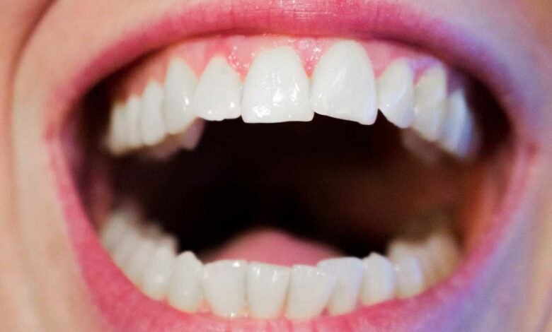 Welche Munddusche empfehlen Zahnärzte?