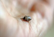 Wie schnell zeigt sich Borreliose?