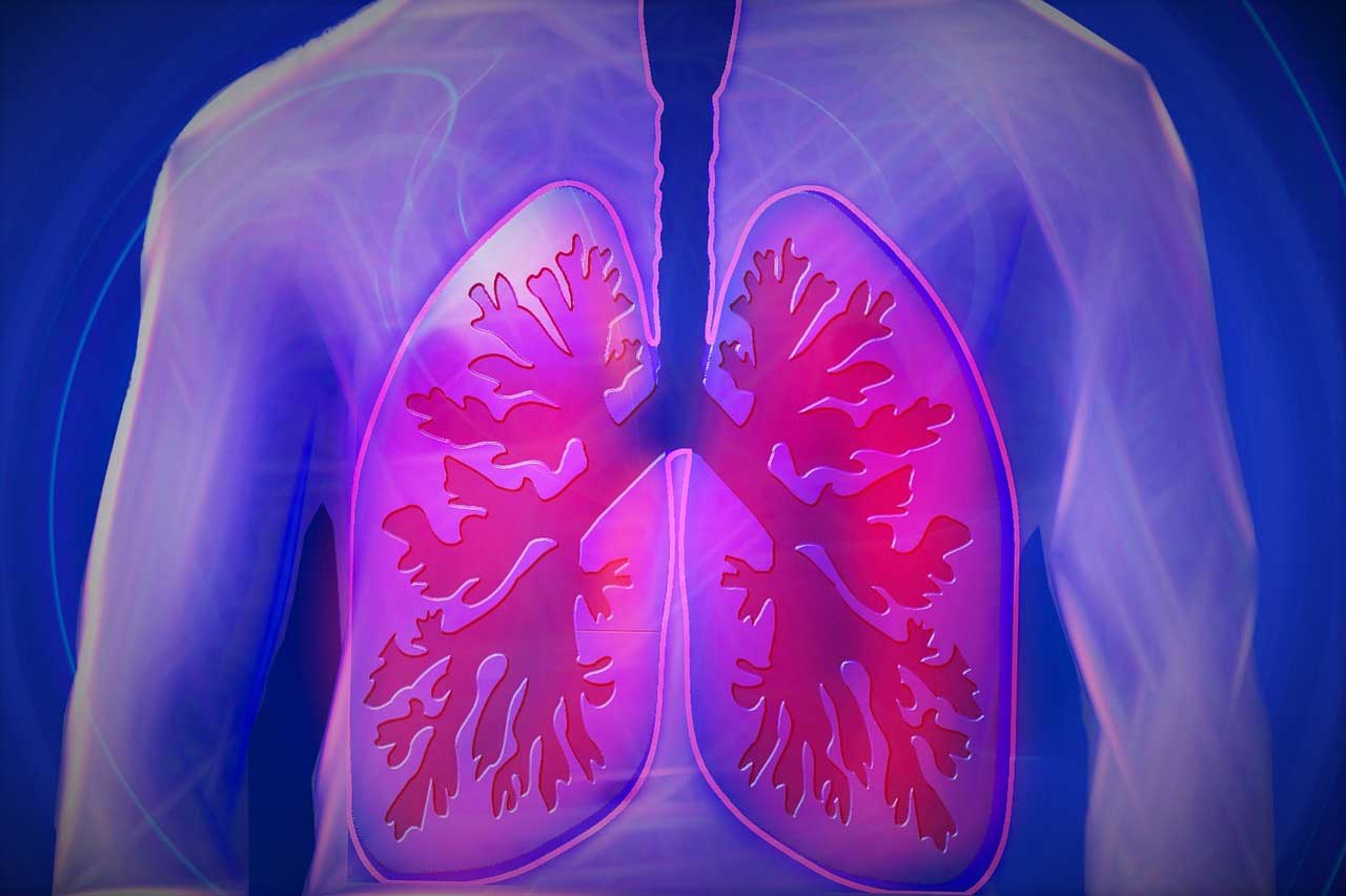 Lungenentzündung – Symptome und Dauer