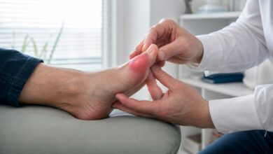 Ärztliche Untersuchung eines entzündeten Großzehengelenks bei Fußgicht