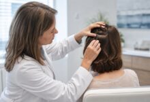 Dermatologische Untersuchung bei Haarausfall