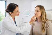 Ärztliche Untersuchung bei Lippenherpes