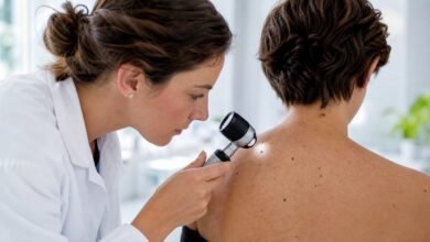 Dermatologische Untersuchung eines Muttermals mit Dermatoskop