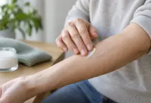 Frau pflegt eine geschlossene Narbe am Unterarm behutsam
