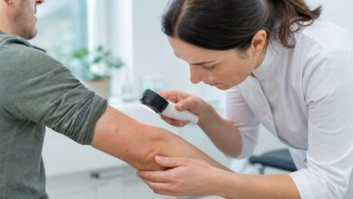 Dermatologische Untersuchung roter Flecken am Unterarm
