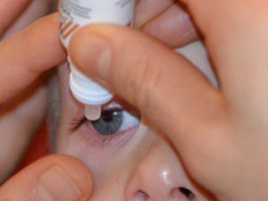 Trockene Augen - Ursachen & Behandlung